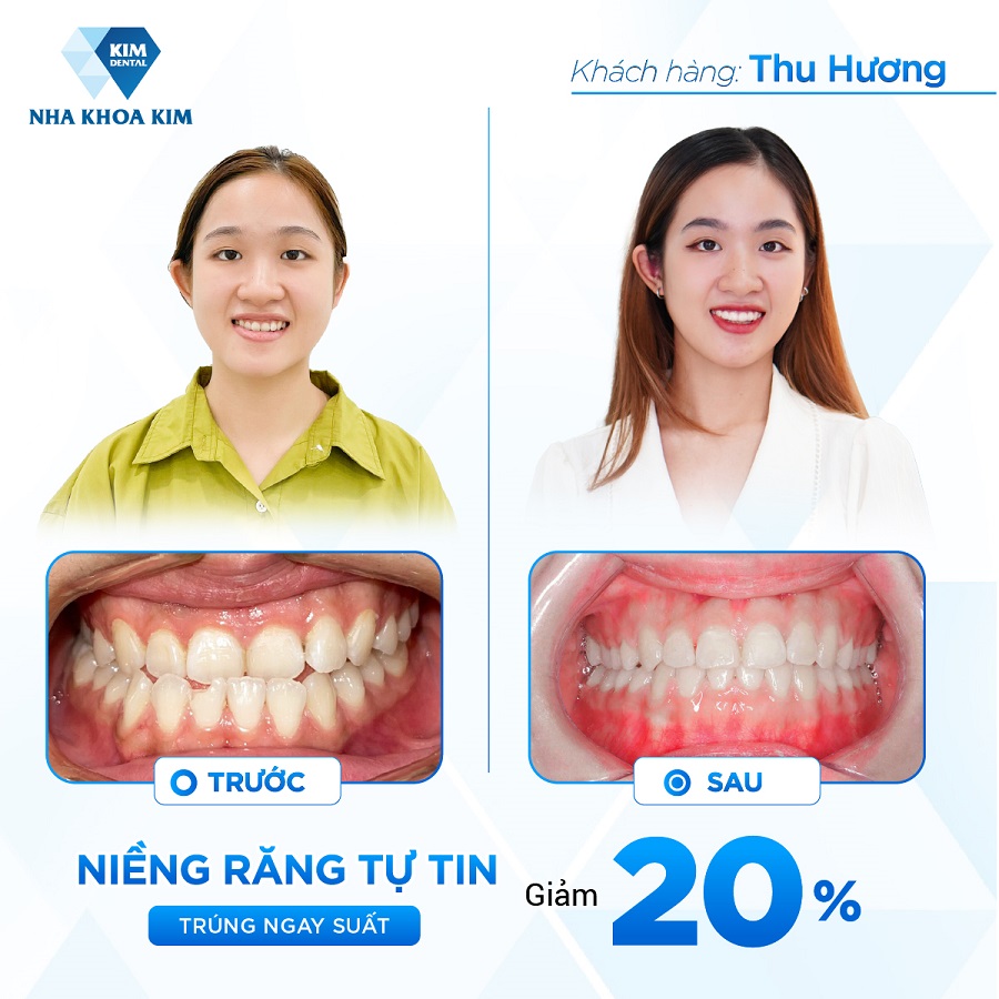 Hình ảnh khách hàng trước - sau khi trải nghiệm dịch vụ phòng khám 