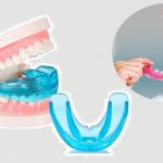 Niềng răng silicon - Chỉnh nha an toàn, thẩm mỹ cao Niềng răng silicon - Chỉnh nha an toàn, thẩm mỹ cao