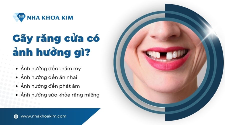 gãy răng cửa để lâu có sao không
