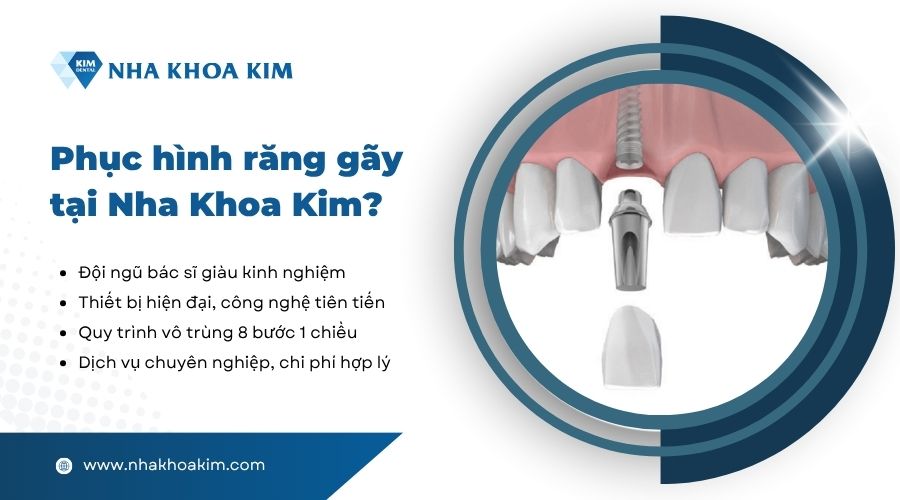 nha khoa kim phục hình răng gãy uy tín, chất lượng