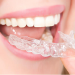 Mách bạn: Địa chỉ niềng răng uy tín ở Hà Nội, chất lượng điều trị tốt Mách bạn: Địa chỉ niềng răng uy tín ở Hà Nội, chất lượng điều trị tốt