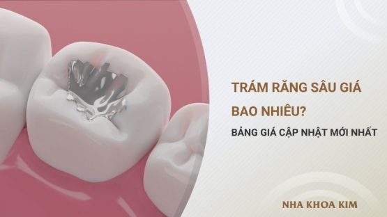 Trám Răng Sâu Bao Nhiêu Tiền? Bảng Giá Tháng 10/2025