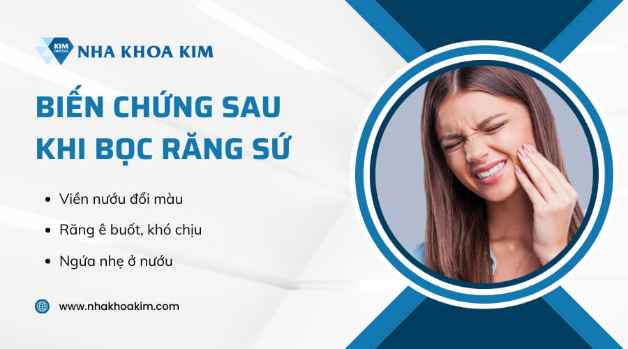 Những lưu ý khi quyết định bọc răng sứ
