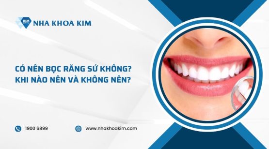 Có nên bọc răng sứ không? Khi nào nên và không nên?