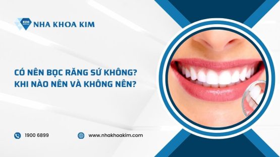 Có nên bọc răng sứ không? Khi nào nên và không nên?