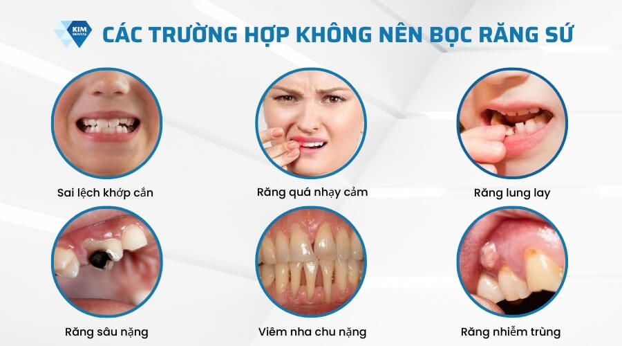 Trường hợp không nên bọc răng sứ