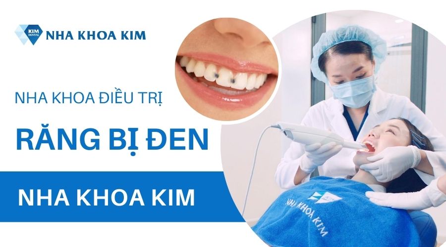 Địa chỉ điều trị răng bị đen hiệu quả