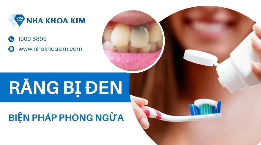 Cách phòng ngừa vết đen trên răng 