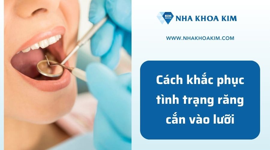 cách khắc phục tình trạng cắn phải môi lưỡi 