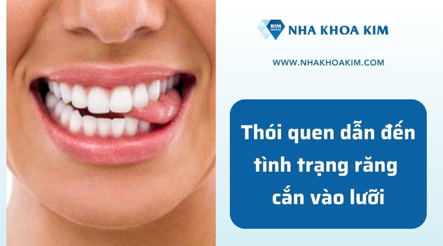 Thói quen dẫn đến tình trạng răng cắn vào lưỡi