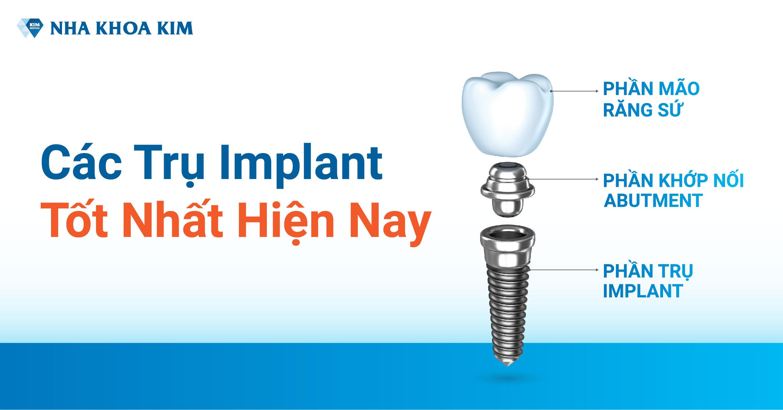 Các Trụ Implant Tốt Nhất Hiện Nay Các Trụ Implant Tốt Nhất Hiện Nay