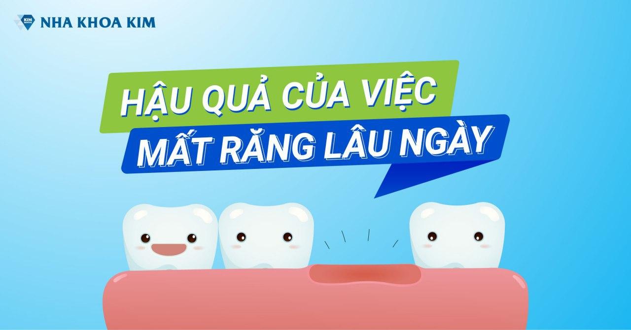 Hậu Quả Của Việc Mất Răng Lâu Ngày Hậu Quả Của Việc Mất Răng Lâu Ngày