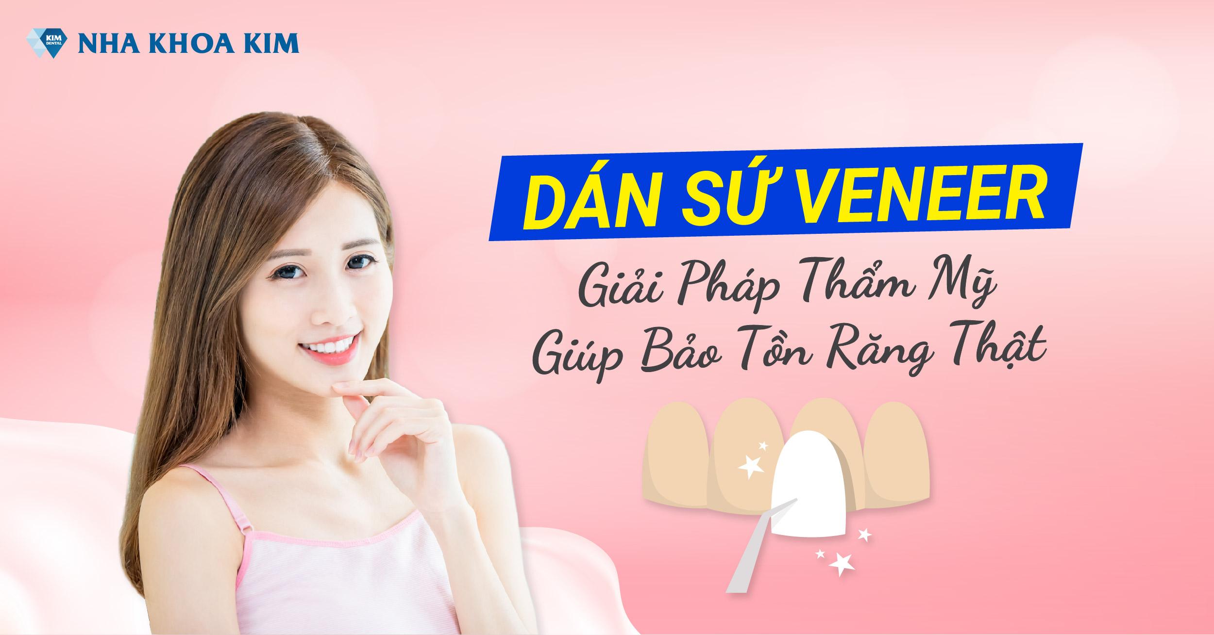 Dán Sứ Veneer – Giải Pháp Thẩm Mỹ Giúp Bảo Tồn Răng Thật Dán Sứ Veneer – Giải Pháp Thẩm Mỹ Giúp Bảo Tồn Răng Thật