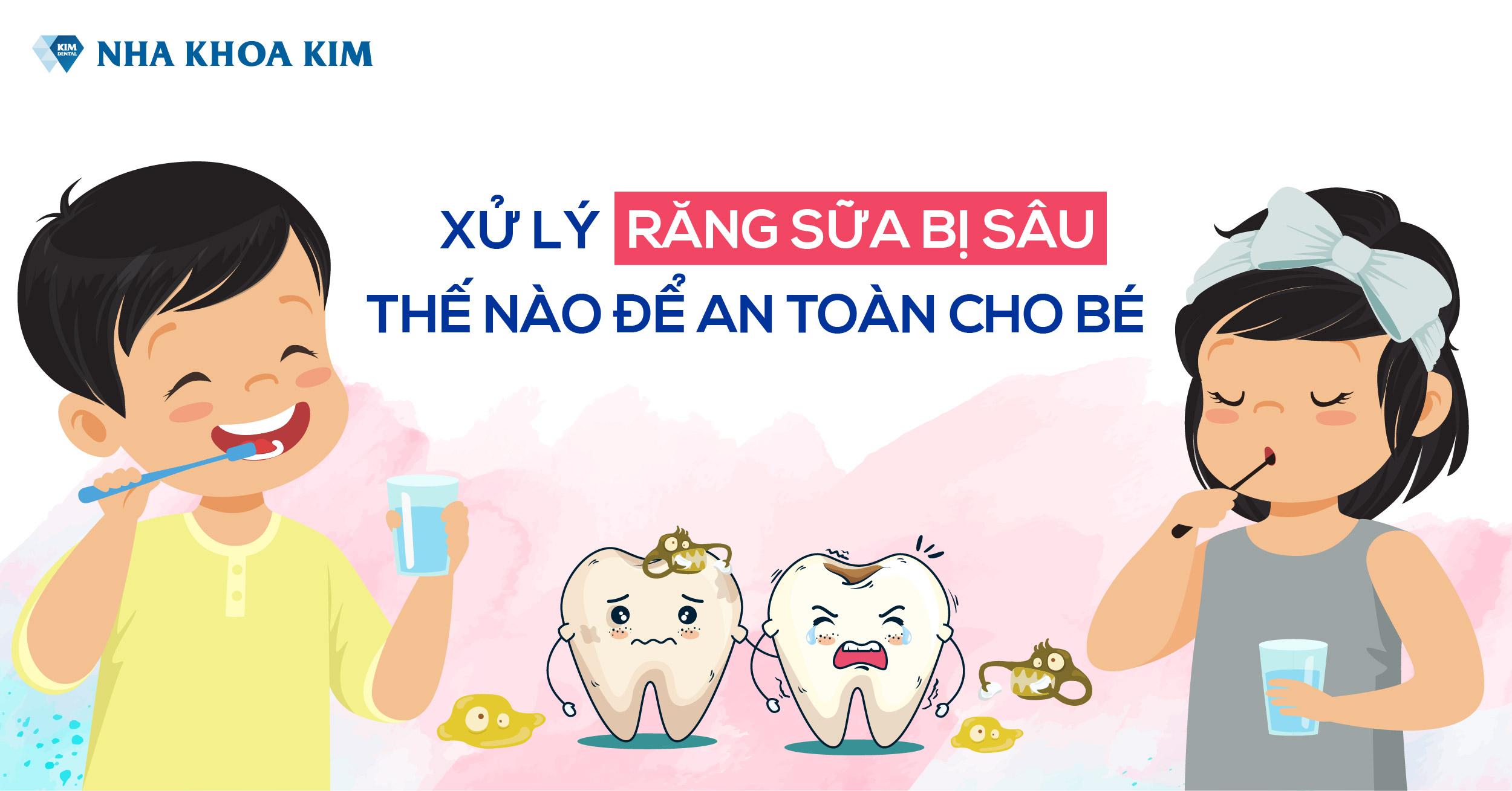 Xử lý răng sữa bị sâu để bảo vệ sức khỏe răng miệng tốt nhất cho bé Xử lý răng sữa bị sâu để bảo vệ sức khỏe răng miệng tốt nhất cho bé