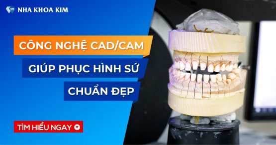 Tìm hiểu công nghệ CAD/CAM trong phục hình răng sứ tại Nha Khoa Kim