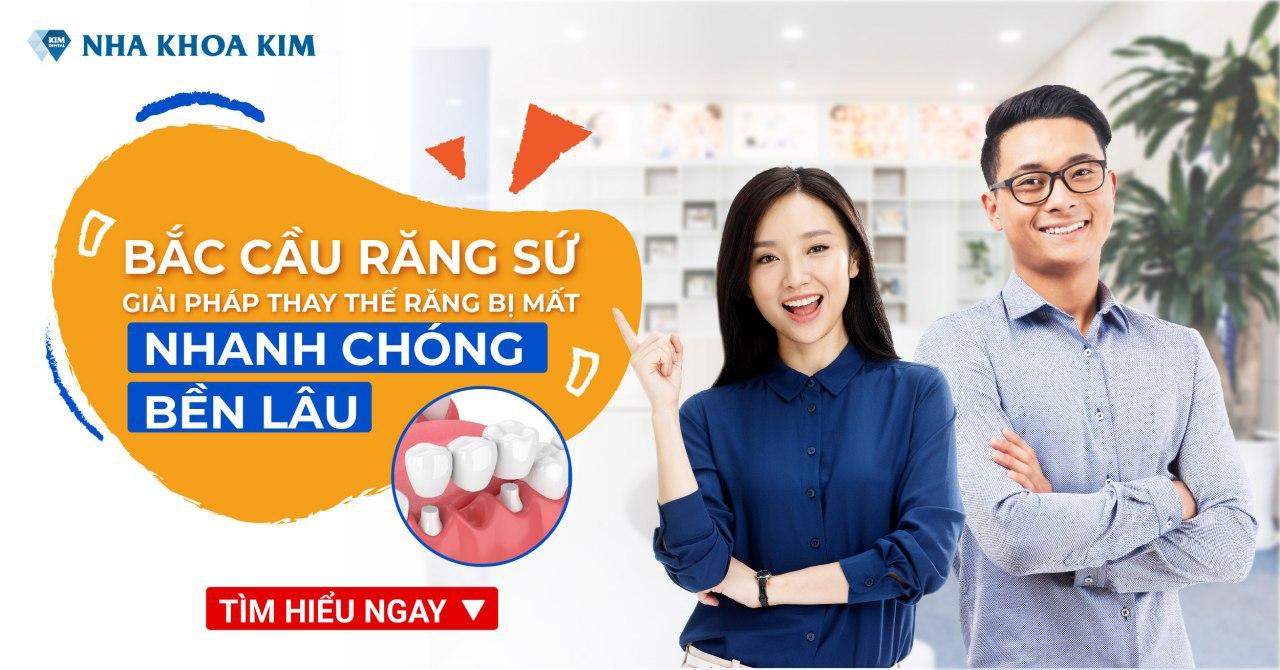 Bắc Cầu Răng Sứ – Giải Pháp Thay Thế Răng Bị Mất Nhanh Chóng, Bền Lâu Bắc Cầu Răng Sứ – Giải Pháp Thay Thế Răng Bị Mất Nhanh Chóng, Bền Lâu