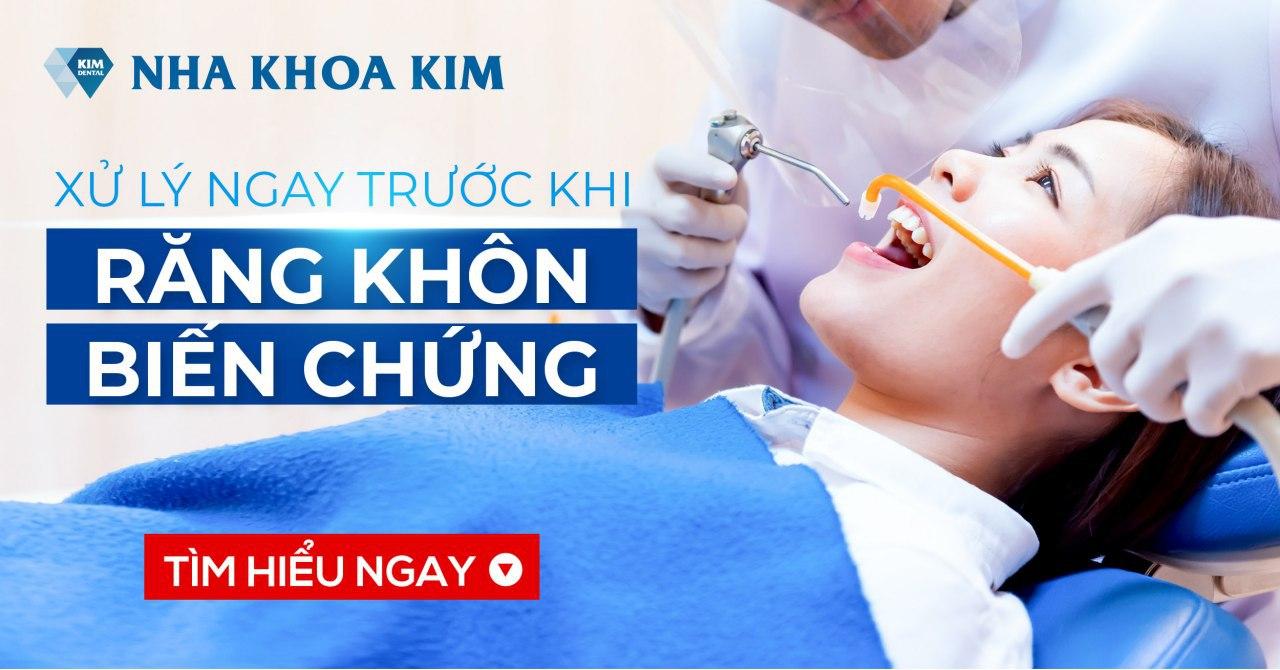 Xử Lý Ngay Trước Khi Răng Khôn Biến Chứng, Ảnh Hưởng Tới Răng Cấm Xử Lý Ngay Trước Khi Răng Khôn Biến Chứng, Ảnh Hưởng Tới Răng Cấm