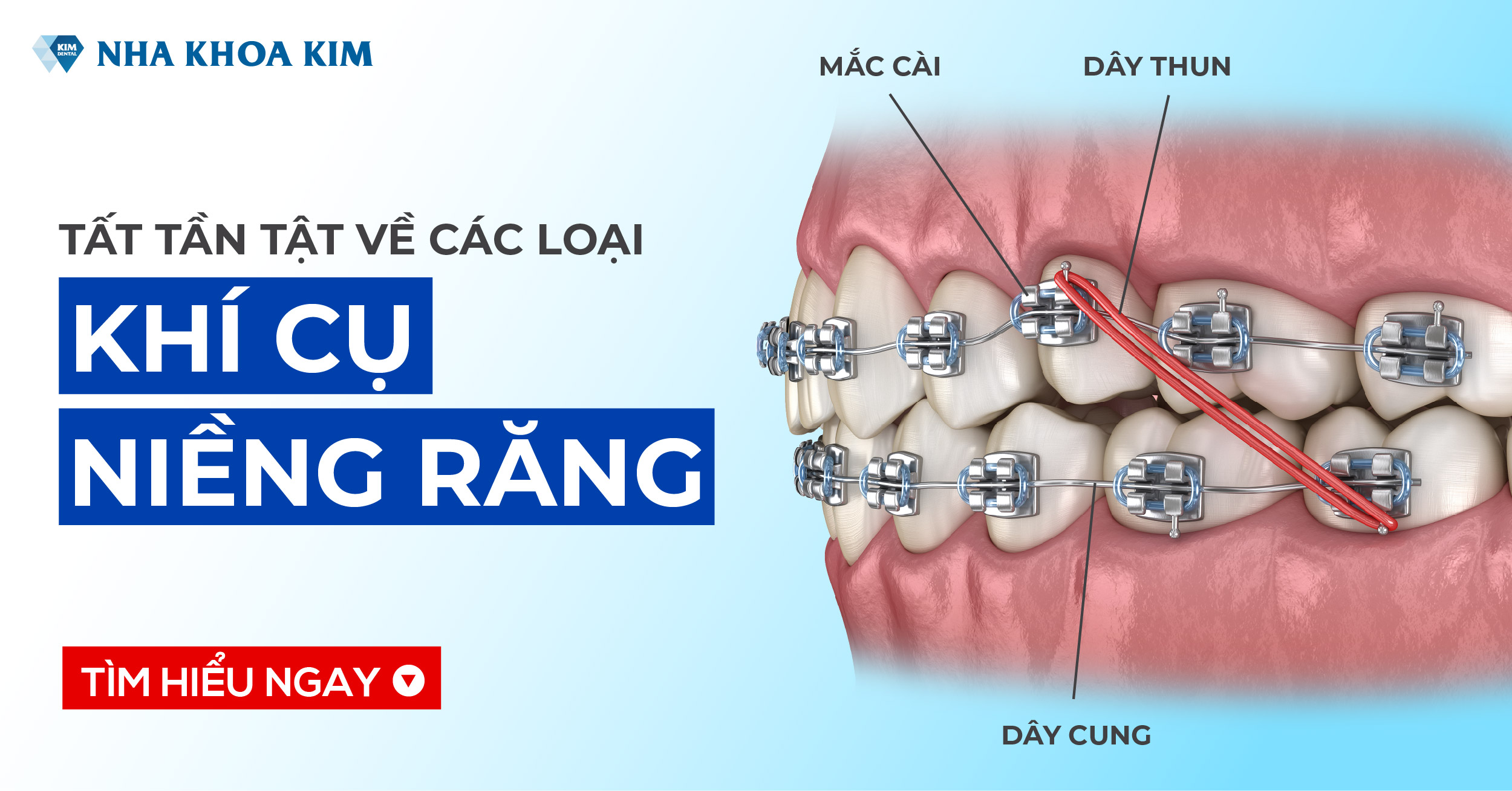 Khi nào nên niềng răng Độ tuổi niềng răng hiệu quả nhất  Nha khoa Vân Anh