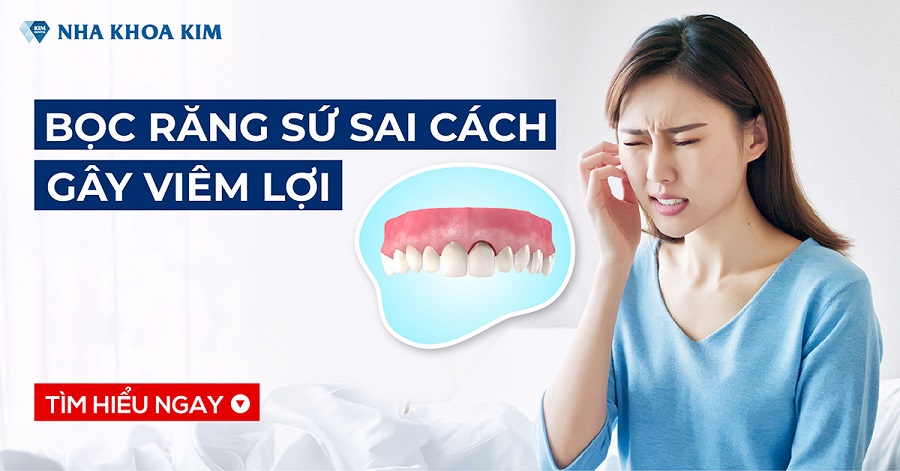 Bọc Răng Sứ Sai Cách Gây Viêm Lợi Bọc Răng Sứ Sai Cách Gây Viêm Lợi