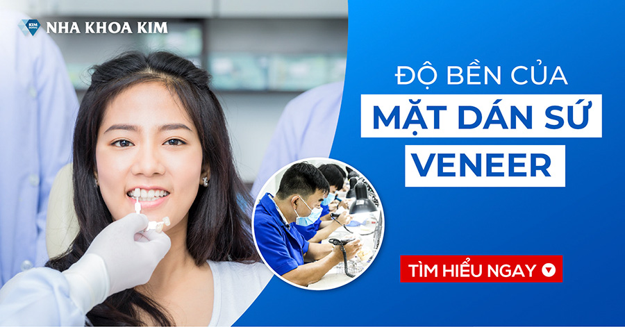 Độ Bền Của Mặt Dán Sứ Veneer Độ Bền Của Mặt Dán Sứ Veneer