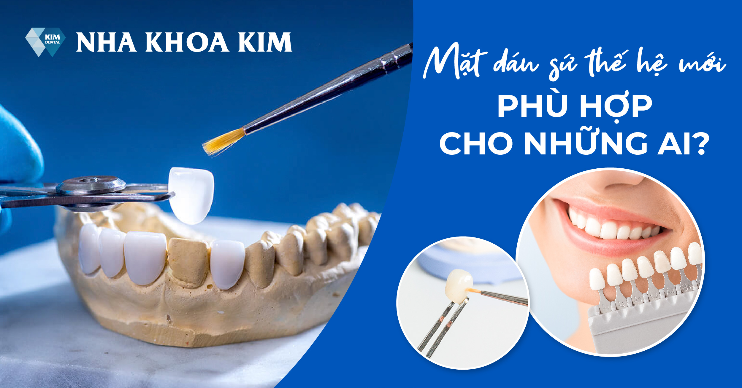 Mặt Dán Sứ Thế Hệ Mới, Phù Hợp Cho Những Ai? Mặt Dán Sứ Thế Hệ Mới, Phù Hợp Cho Những Ai?