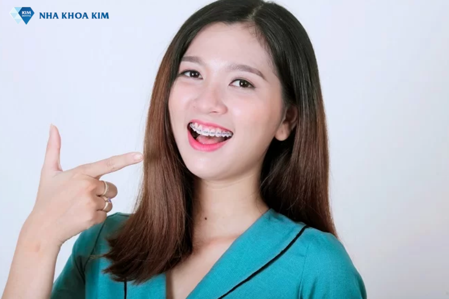 Hotgirl, người mẫu Thanh Yến đánh giá cao về chất lượng, dịch vụ khi niềng răng tại Nha Khoa Kim