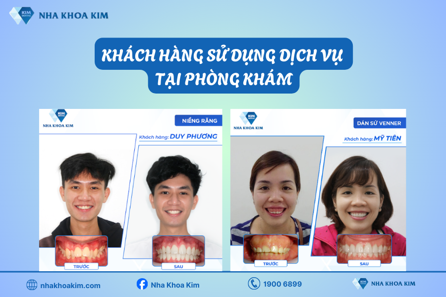 Hình ảnh khách hàng sau khi trải nghiệm dịch vụ tại Nha Khoa Kim quận 5