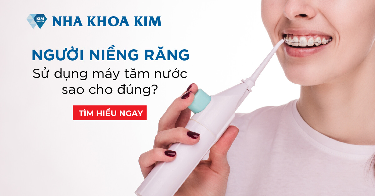 Niềng răng có nên dùng tăm nước? Lợi ích và cách sử dụng