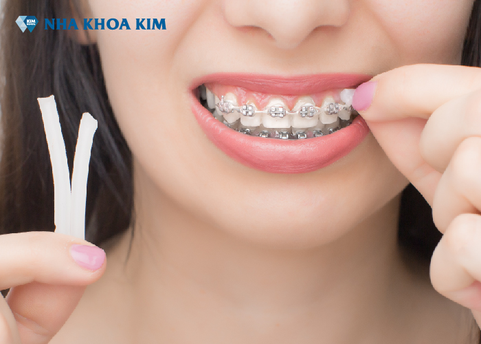 Sử dụng sáp nha khoa thế nào hiệu quả?