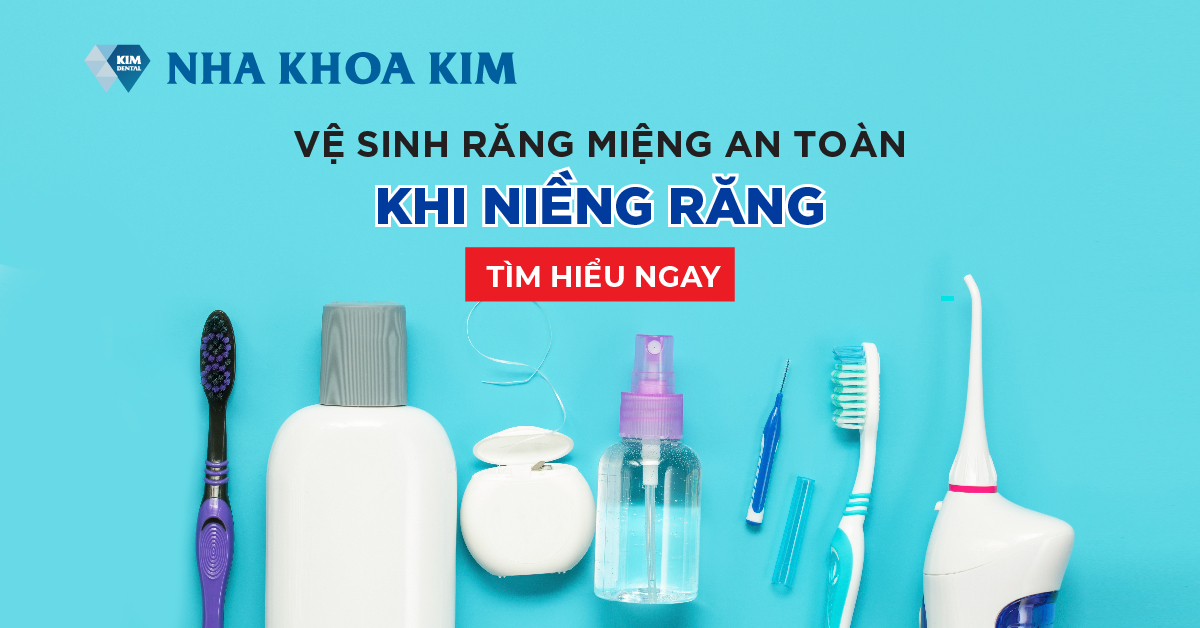 Hướng dẫn cách vệ sinh răng niềng sạch đúng cách