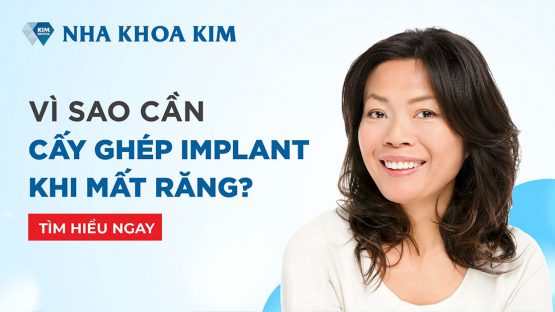 Vì sao cần cấy ghép Implant khi mất răng?