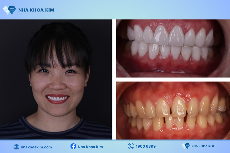 Hình ảnh khách hàng trước - sau khi trải nghiệm dịch vụ của phòng khám