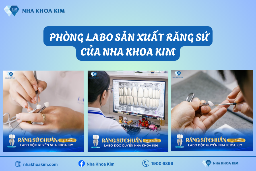 Răng sứ sản xuất độc quyền tại phòng Labo của Nha Khoa Kim