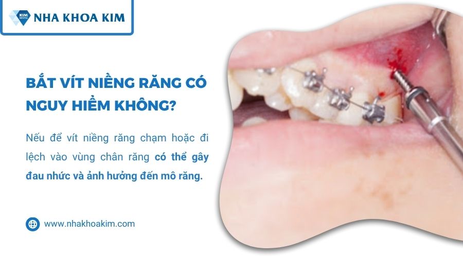 cắm minivis có nguy hiểm không