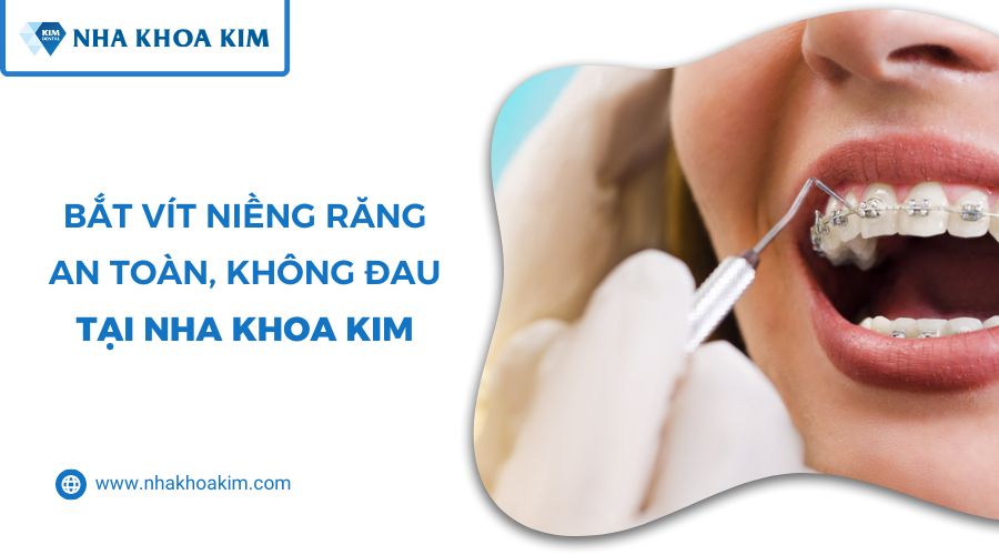 cắm vít niềng răng không đau tại Nha Khoa Kim