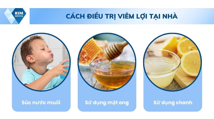 mẹo chữa viêm lợi tại nhà