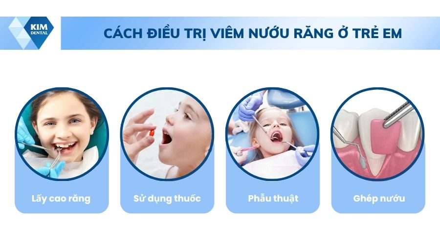 cách điều trị viêm nướu răng ở trẻ em