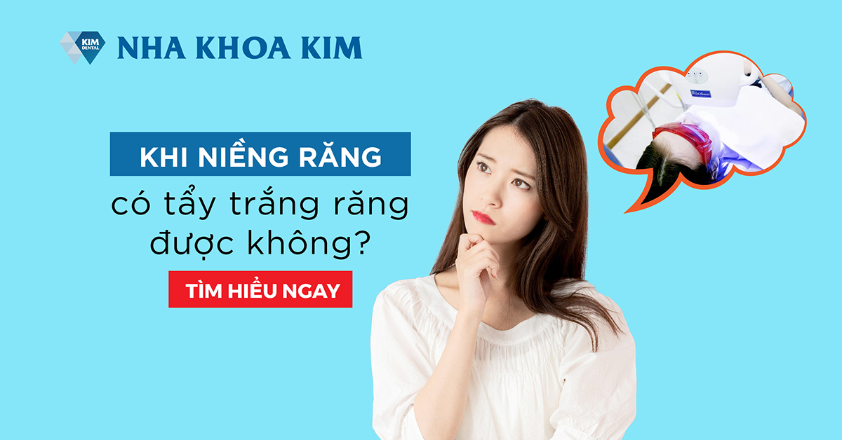Khi niềng răng có tẩy trắng răng được không?