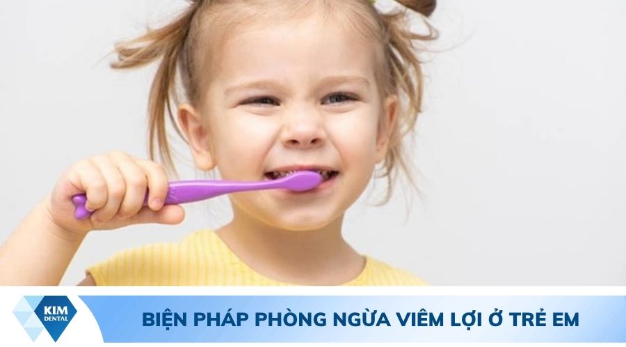 biện pháp phòng ngừa trẻ bị viêm lợi 