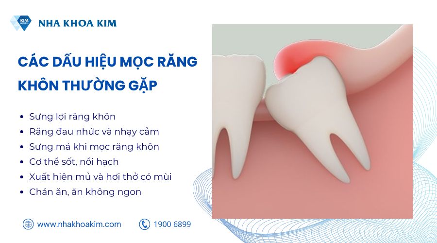 Các dấu hiệu thường gặp khi mọc răng khôn