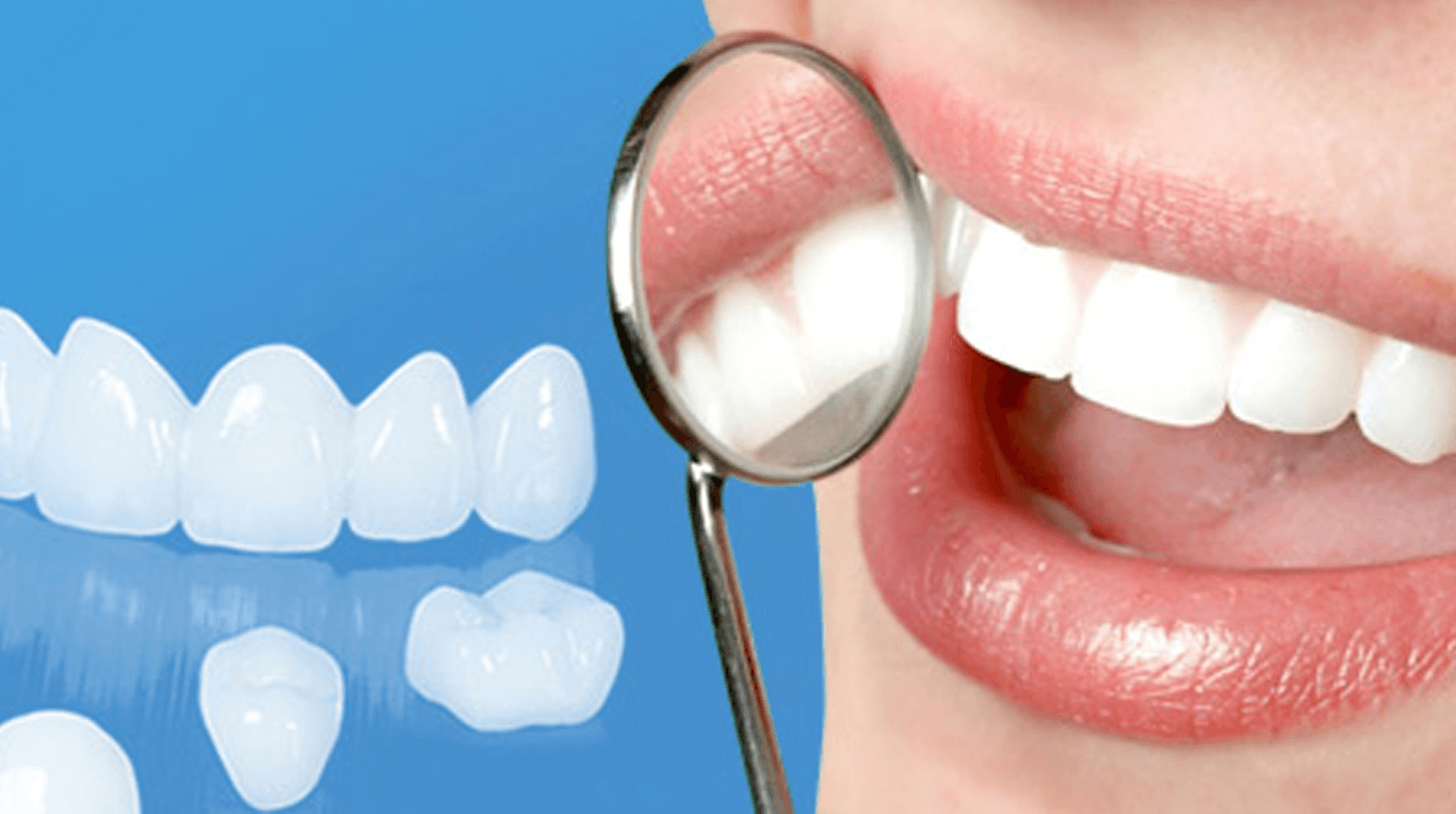 Thực hiện các phương pháp làm răng giả tại Nha Khoa Kim