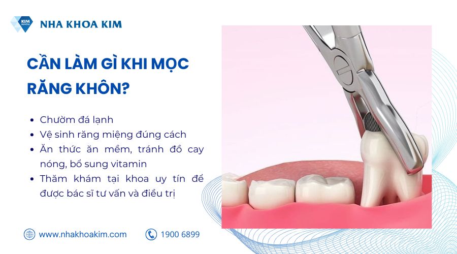 Cần làm gì khi mọc răng khôn?