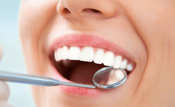 Răng cửa có 8 chiếc răng ở cả hai hàm răng