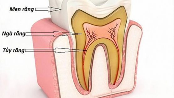 Nha Khoa Kim điều trị tủy răng chưa đóng chóp an toàn, hiệu quả cao