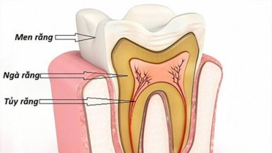 Nha Khoa Kim điều trị tủy răng chưa đóng chóp an toàn, hiệu quả cao