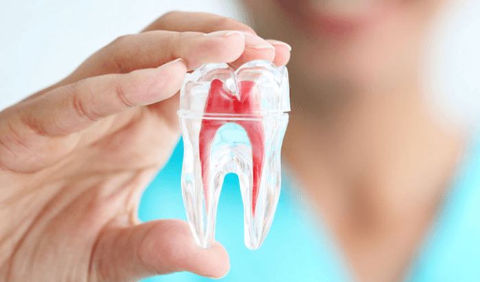 Trường hợp bắt buộc phải điều trị tủy răng