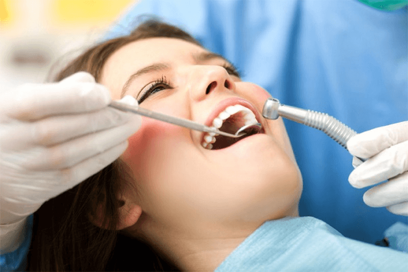 Lấy cao răng bị chảy máu có thể xảy ra ở một số đối tượng