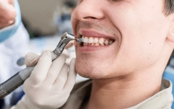 Cao răng là nguyên nhân gây nên nhiều bệnh lý răng miệng