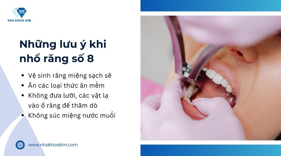 lưu ý khi nhổ răng số 8