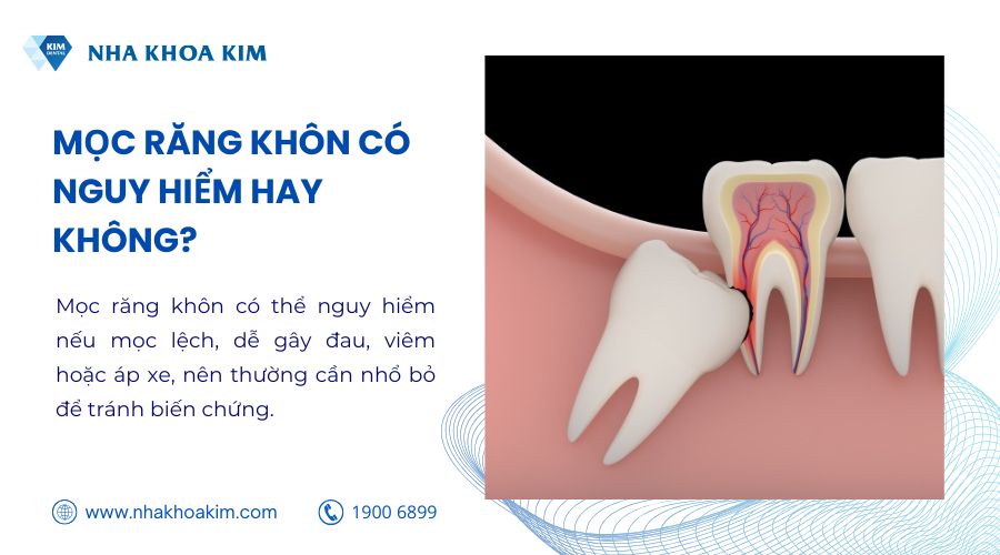 Mọc răng khôn có nguy hiểm không
